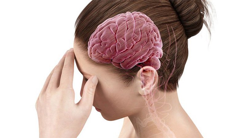 Nhồi máu não có nguy hiểm không? 1 Hình 1: Giải đáp thắc mắc nhồi máu não có nguy hiểm không?